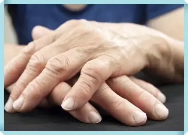 류마티스 질환 효과적으로 관리하는 방법 알아보기 1 류마티스 질환 관리